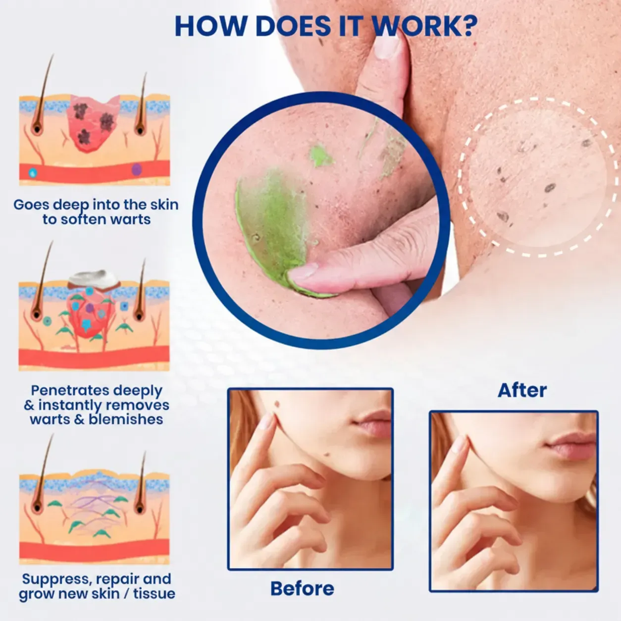 Tavunae® NatureErase Instant Mole & Spot Cream for targeted skincare