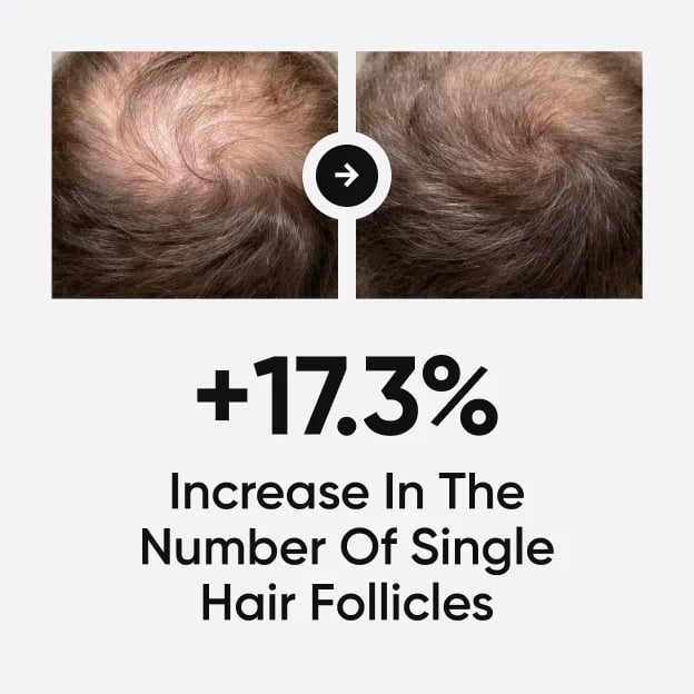 Moérie men's scalp spray