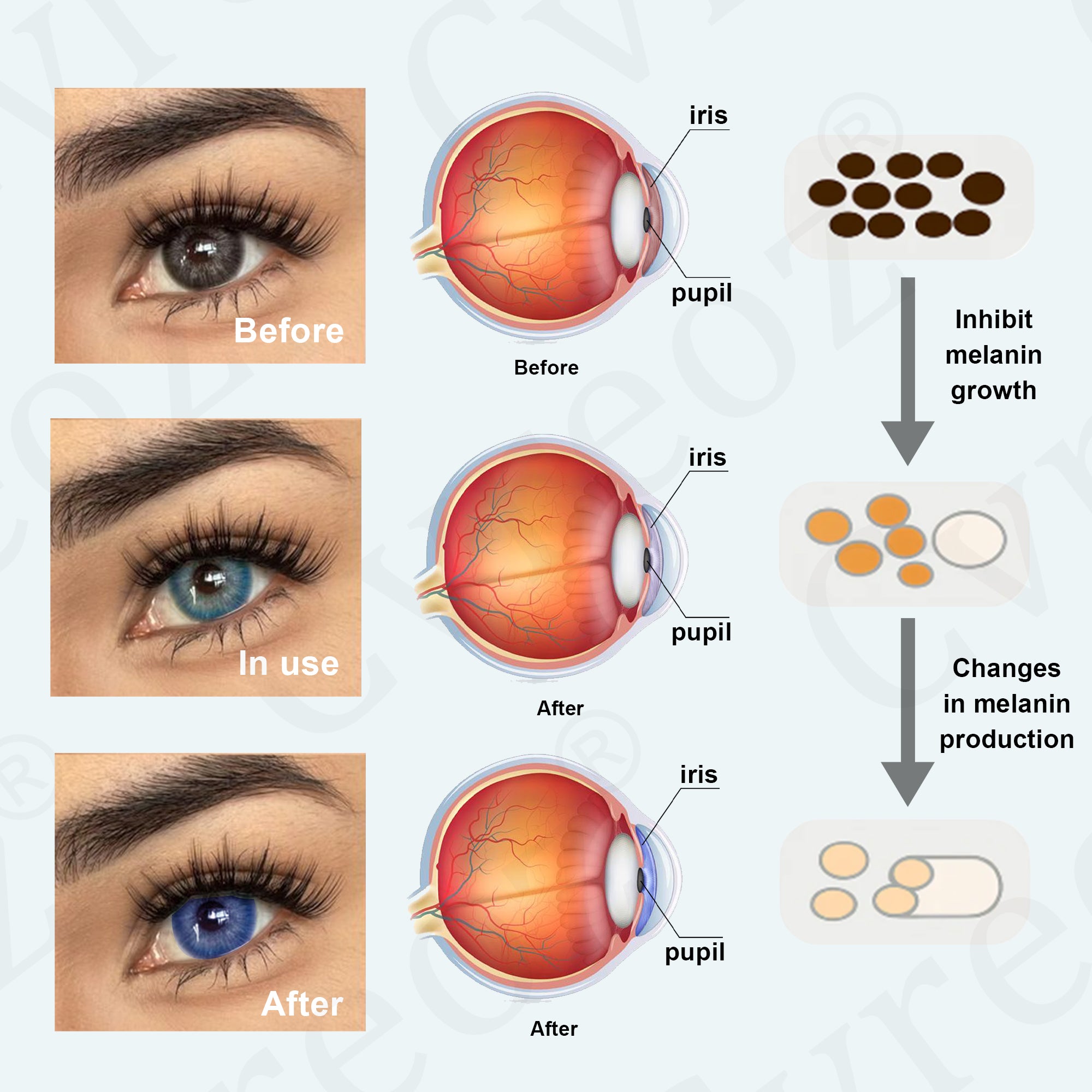 Cvreoz® EyeCandy Drop designed to shift the appearance of natural iris color