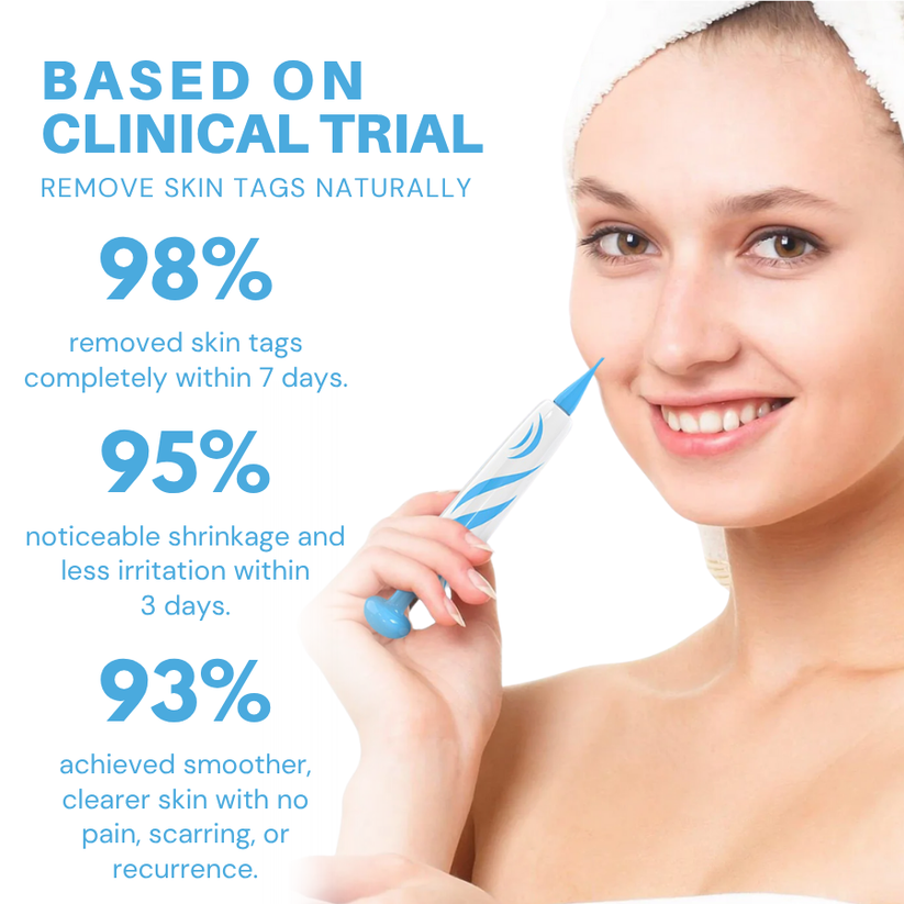 Fivfivgo Painless At-home Skin Tag Removal Pen