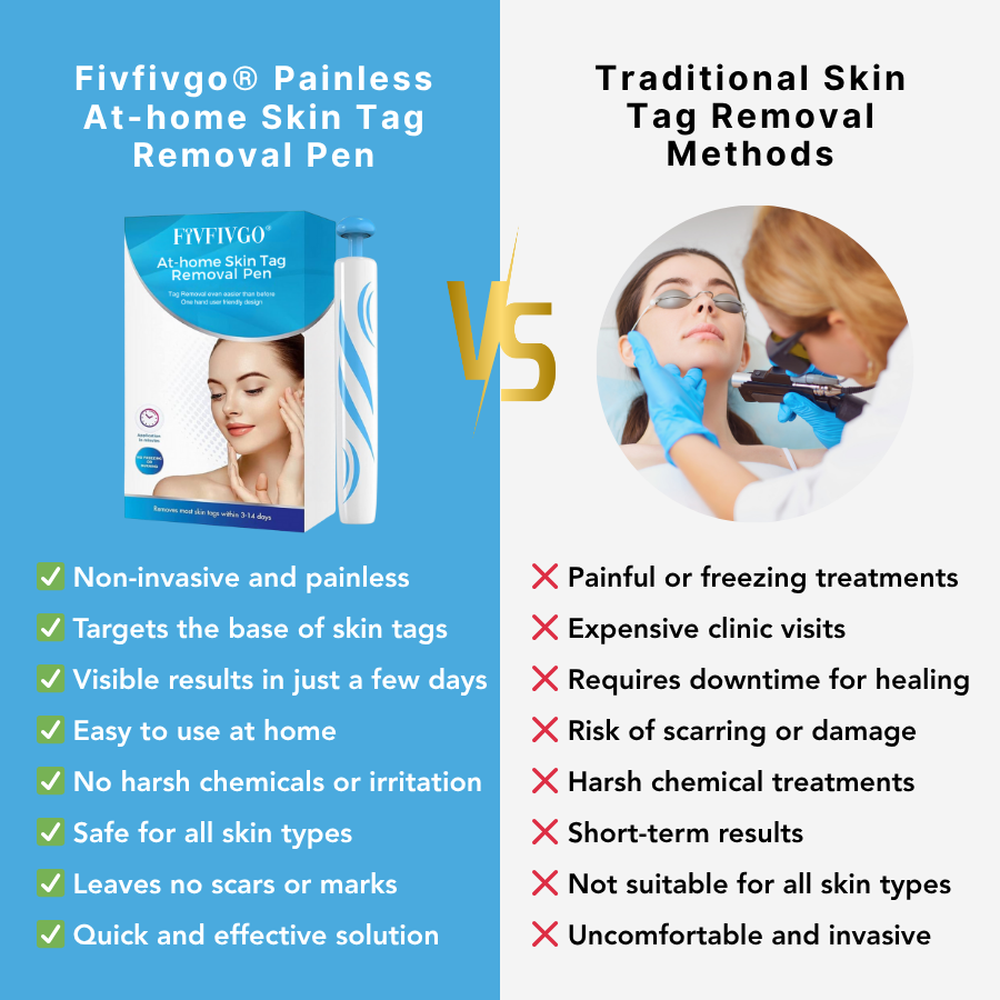 Fivfivgo at-home skin tag device with precision band placement