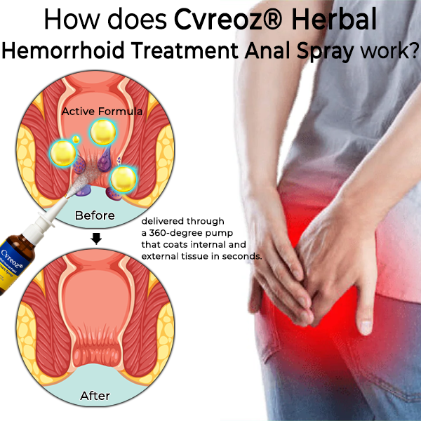 Cvreoz® 50 mL herbal pump spray