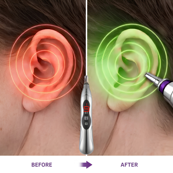 TinniEase non-invasive tinnitus support device