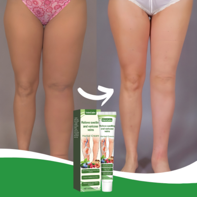 VeinCalm Leg Cream
